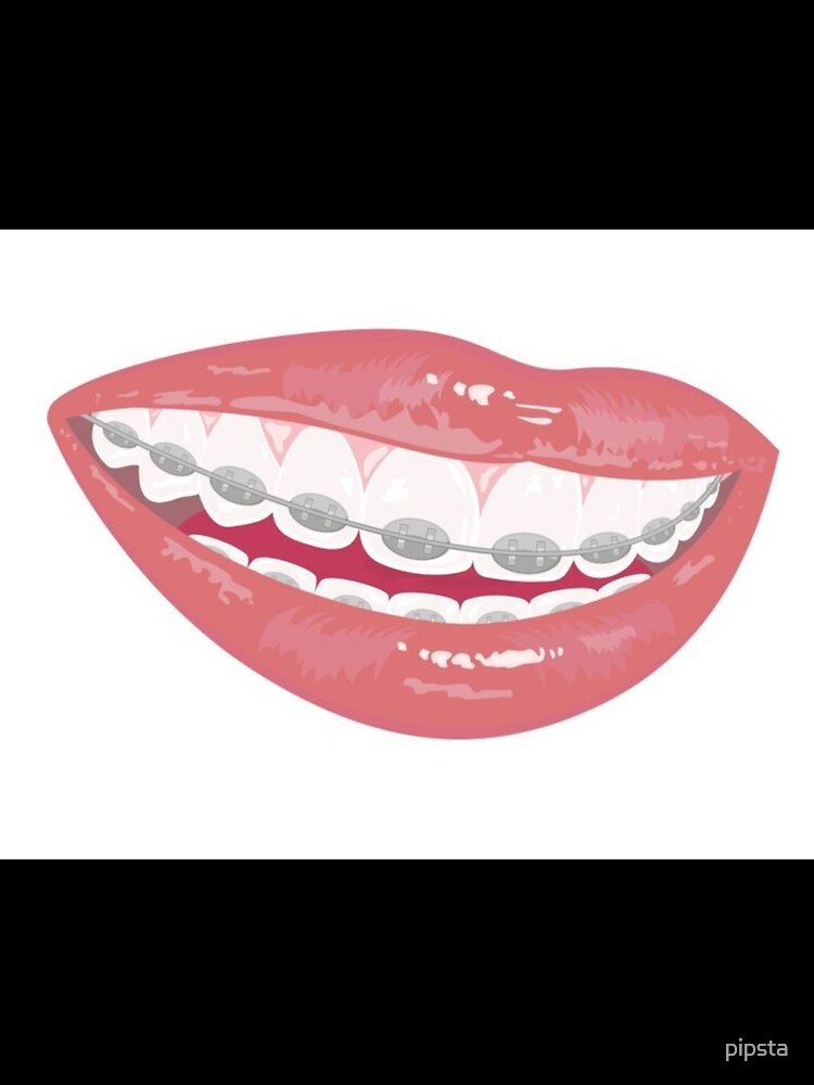 Braces by Sipsta Unisex